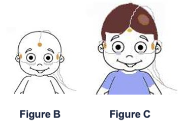 Electroretinogram diagram for children